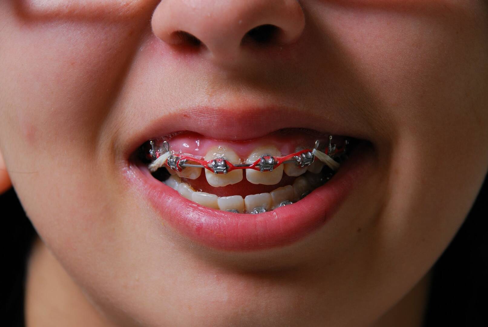 Dentist Conway SC