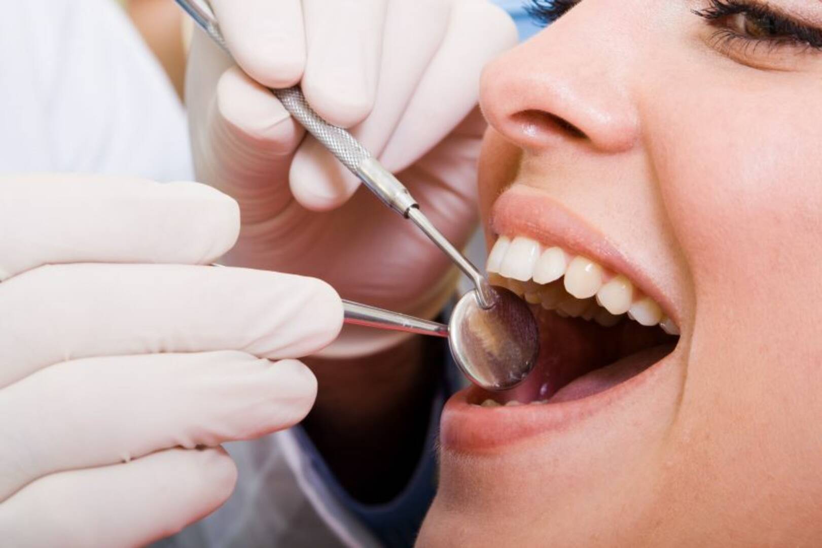Teeth Whitening Kelowna