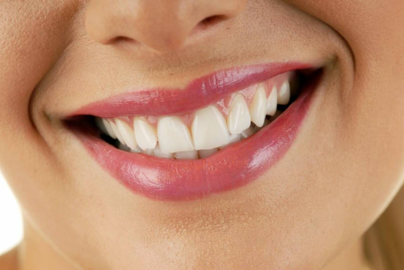 Dental Whitening Ham Lake Mn